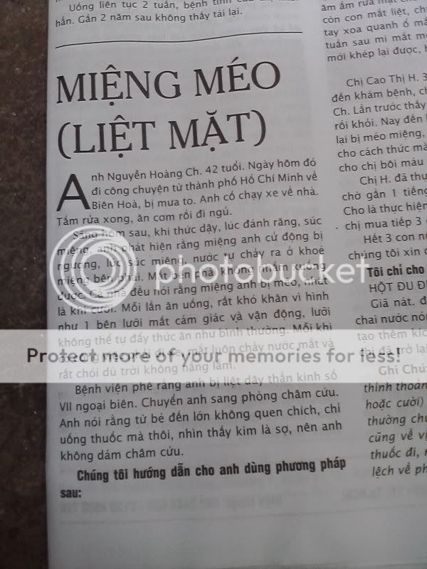 Trị Miệng méo (liệt mặt) !